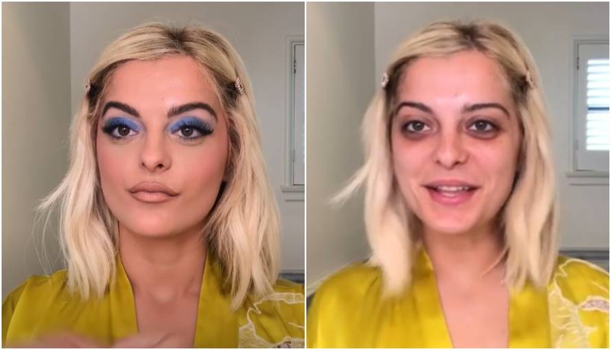 Albanka šokirala podočnjacima: 'To nije normalno, idi doktoru'