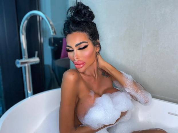 FOTO Potrošila više od 100 tisuća eura kako bi izgledala kao 'ljudska barbika' - Liječnici zgroženi