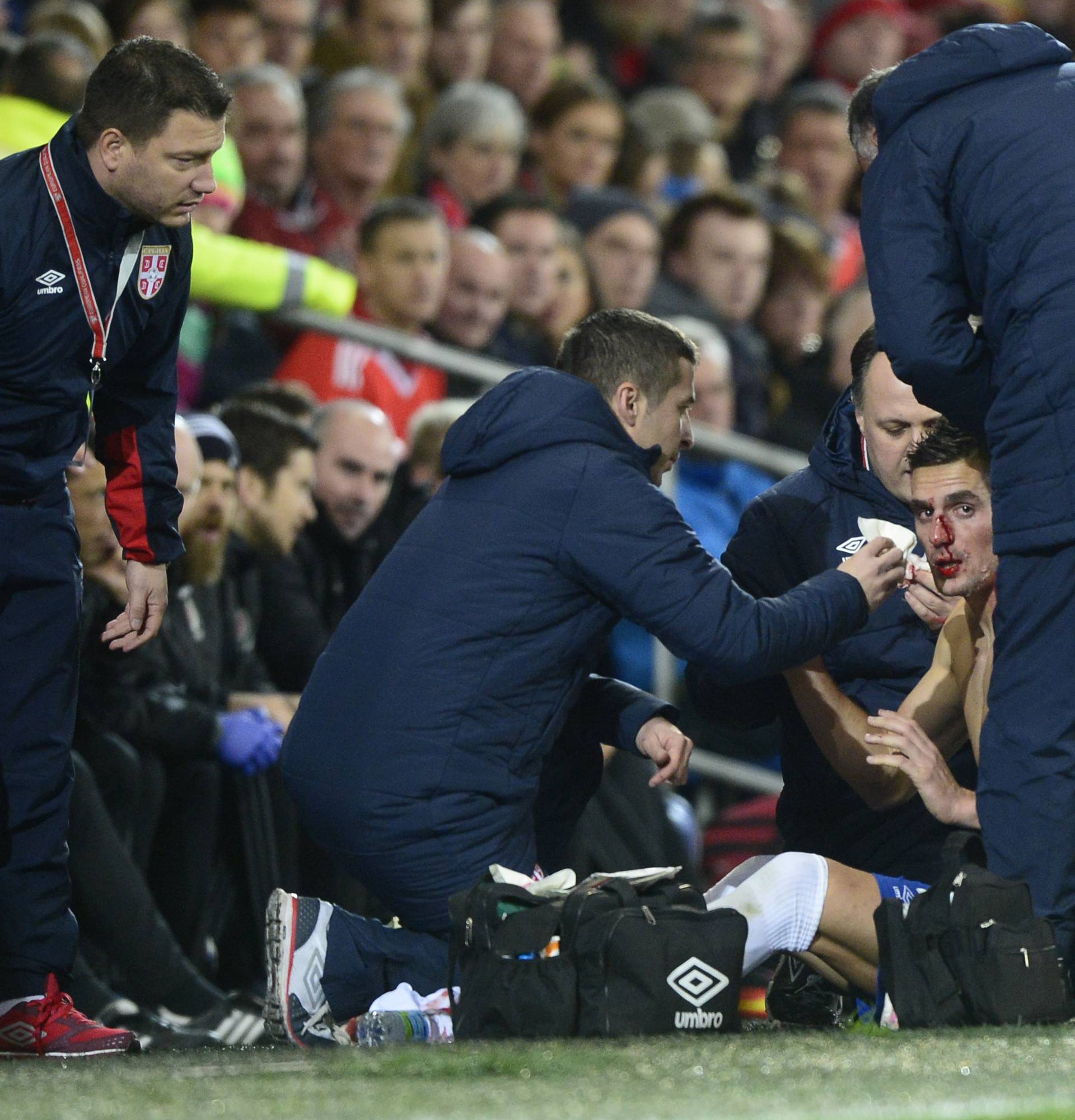 Serbia's Dusan Tadic sustains a facial injury