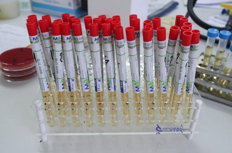 U javnim zahodima u Zagrebu moglo bi se čak i jesti s poda