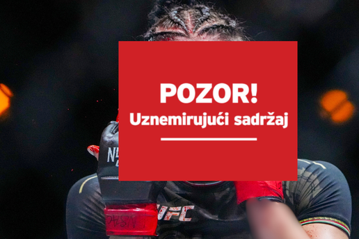 UZNEMIRUJUĆE Šok i horor za Meksikanku: Ovo je najgora posjekotina u povijesti UFC-a