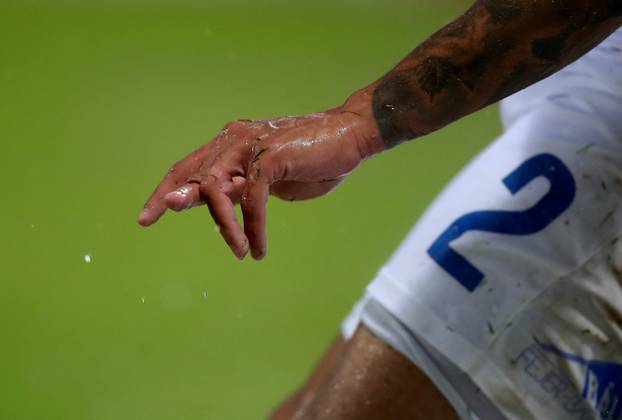 Velika Gorica: Igrač Osijeka, Igor Silva, tijekom pada na utakmici s Goricom slomio prst