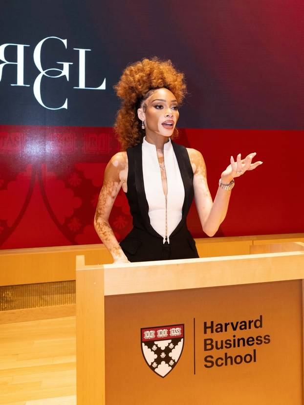 FOTO Rugali su joj se zbog bolesti, a danas je obožavaju zbog jedinstvenog izgleda