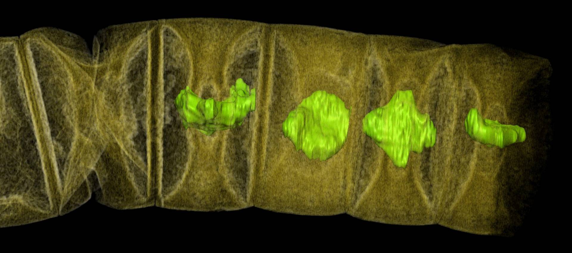 An X-ray tomographic picture of fossil thread-like red algae, tinted to show detail