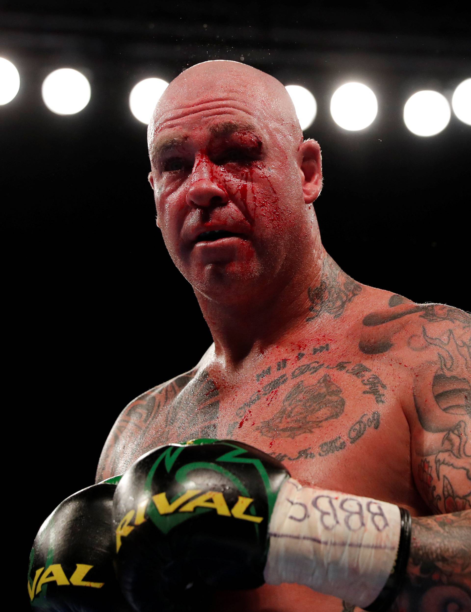 Dillian Whyte vs Lucas Browne - WBC Silver Heavyweight Title