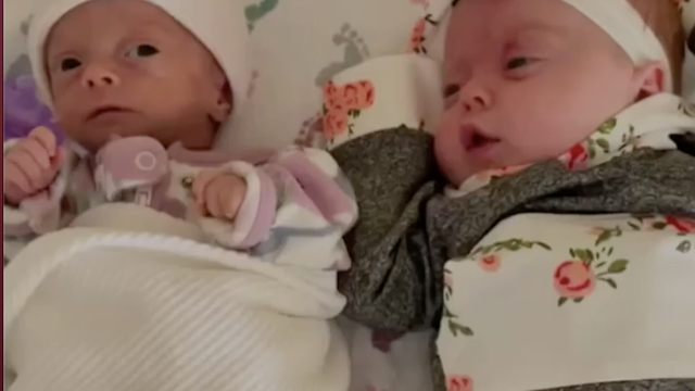 Rođena tri puta manja od sestre blizanke: 'Čudo je što je živa'