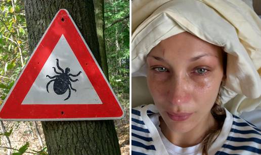 Bella Hadid već dugo boluje od lajmske bolesti: Ovo su ključni znakovi i savjeti za prevenciju