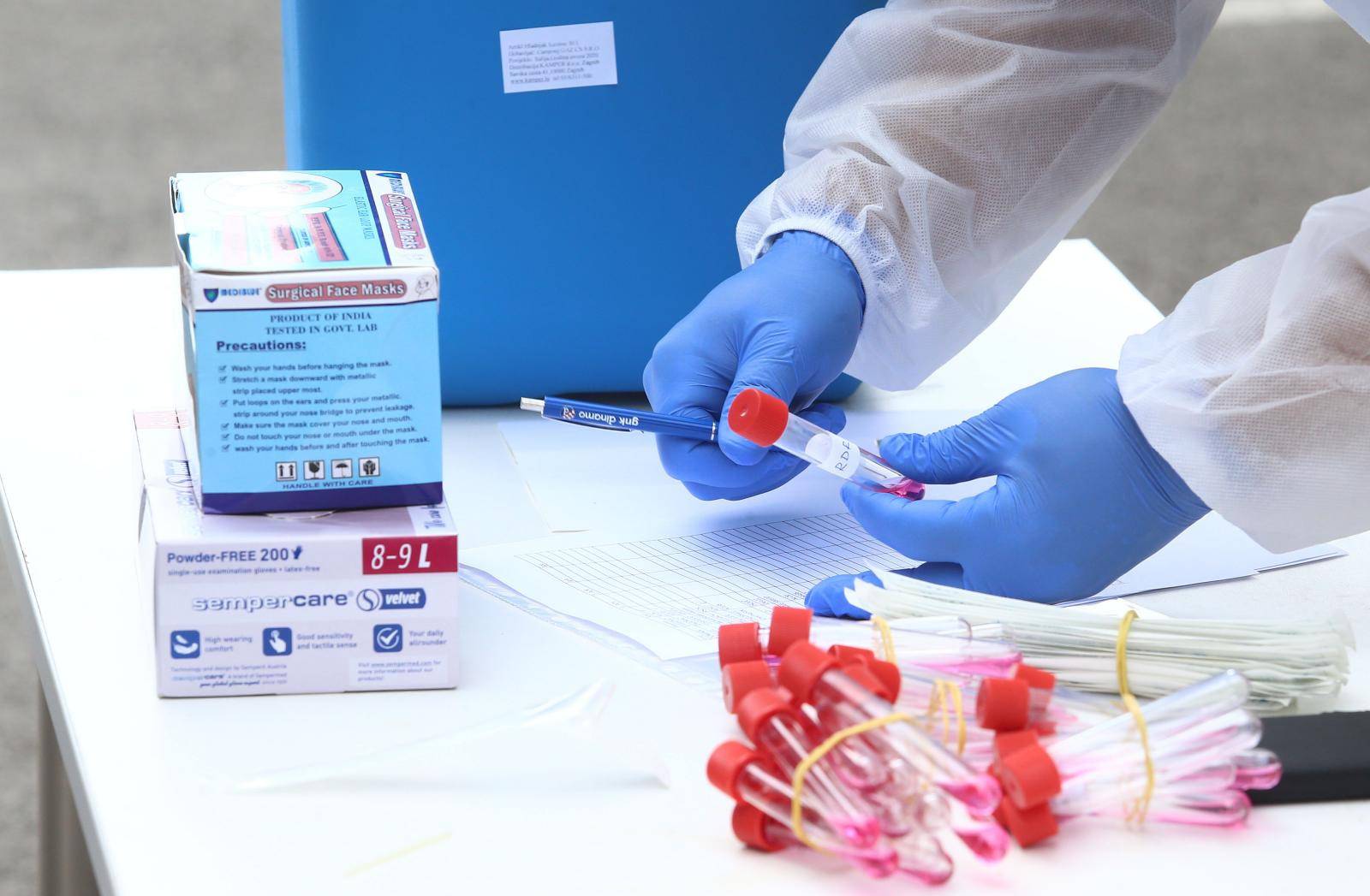 Testira se eksperimentalni lijek za sprječavanje krvnih ugrušaka prilikom zaraze korona virusom