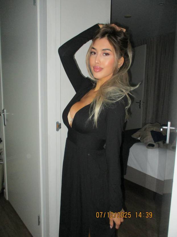 FOTO Sve joj je na mjestu! Prije su je ismijavali, danas zarađuje ogromne cifre kao model