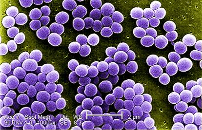 Superbakterija otporna na sve antibiotike širi se bolnicama