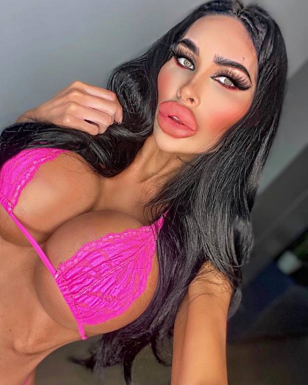 FOTO Potrošila više od 100 tisuća eura kako bi izgledala kao 'ljudska barbika' - Liječnici zgroženi