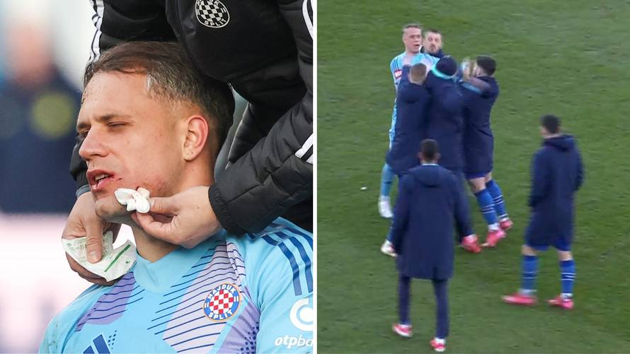 Galešić brutalno kopačkom u lice Lučića! Hajdukov golman nakon završetka dobio šamar