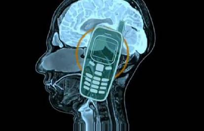 Upotreba mobitela  pomaže u sprečavanju Alzheimera?