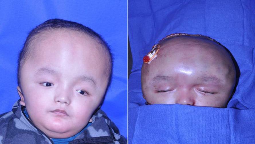 Johns Hopkins Childern's Center