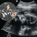 Horor u SAD-u: U kući poznate aktivistkinje protiv pobačaja policija pronašla pet fetusa...