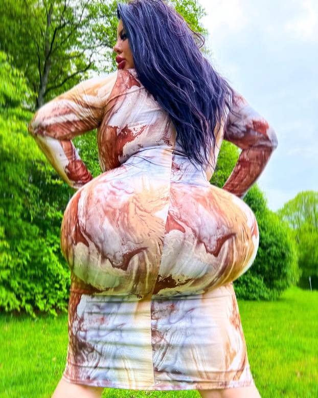 FOTO Stražnjica mi teži 45 kila, no već imam u planu sljedeću operaciju, želim imati najveću!