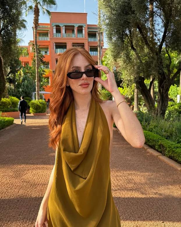 FOTO Posebna ljepota: Milijuni ljudi obožavaju njezine pjegice