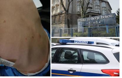 Sud potvrdio optužnicu protiv majke i dadilje: Dječak je imao lomove i ožiljke kao od 'čikova'