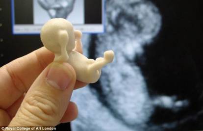 Radi 3D modele fetusa na osnovu slika s ultrazvuka