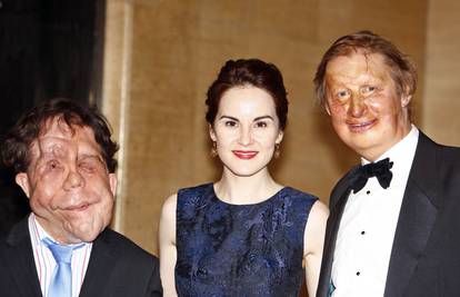 Glumci 'Downton Abbeyja' na večeri udruge Changing Faces