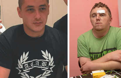 Mlađem Culeju i trojici počeli su suditi za napad na mladića (23): 'Oslijepio sam zbog batinanja'