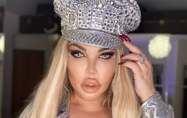 FOTO Mračna strana ovih 'živih' Barbika! Infekcije im 'jedu' kožu i misteriozno umiru. Evo zašto