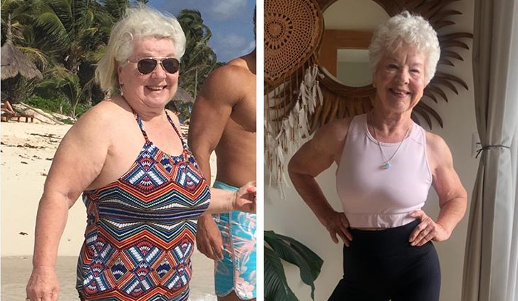 U sedamdesetima izgubila čak 30 kilograma i riješila se tlaka