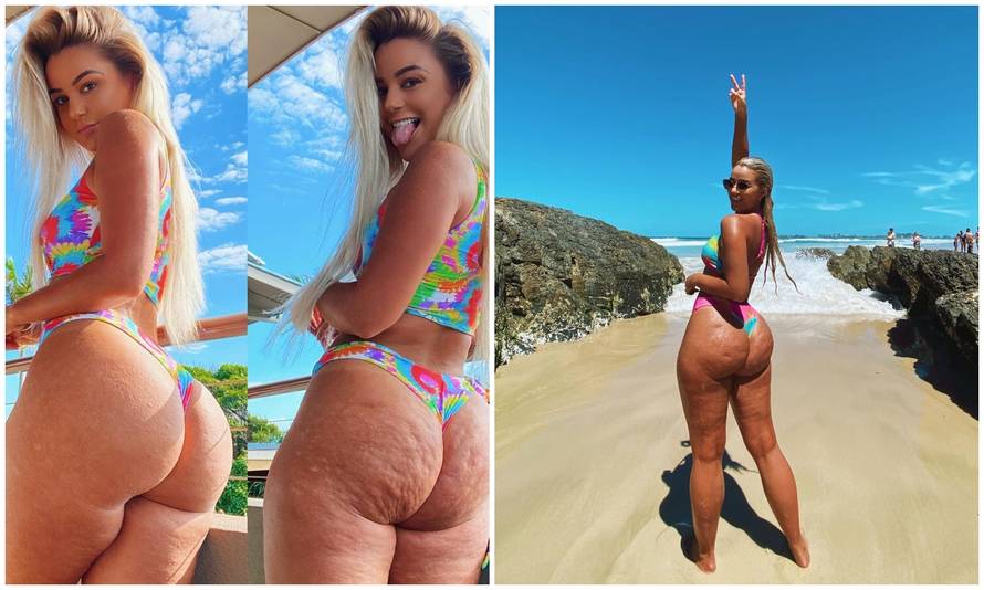 Guza prije i poslije photoshopa: Hej cure, celulit je normalan!