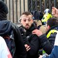 Mladić ostao bez četiri prsta u prosvjedima 'žutih prsluka'
