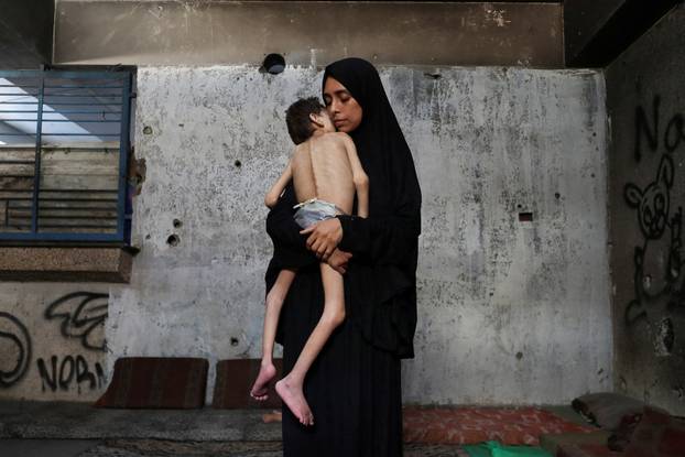 Displaced Palestinian mother Samah Matar holds her malnourished son Youssef, in Gaza City