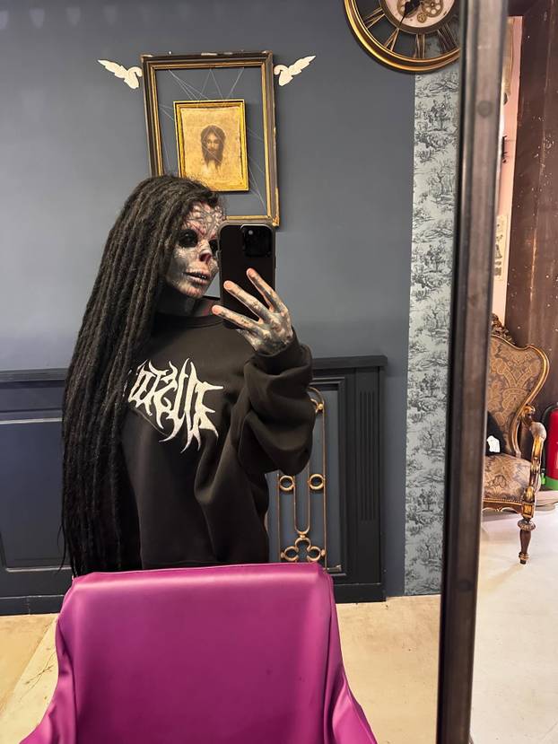 FOTO Uznemirujuće! Uklonila je čak i vrh nosa, a evo kako je izgledala: Šteta, ljepotica si bila