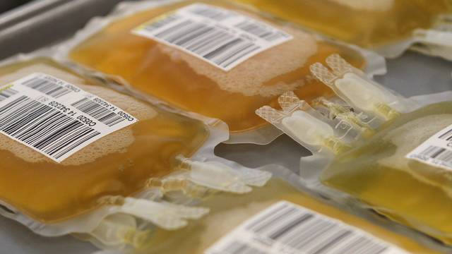 Skandal u Imunološkom: Čak 20 tona krvne plazme propalo!