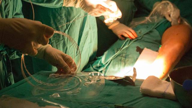 Plastični kirurg optužen zbog smrtonosnog brazilskog liftinga