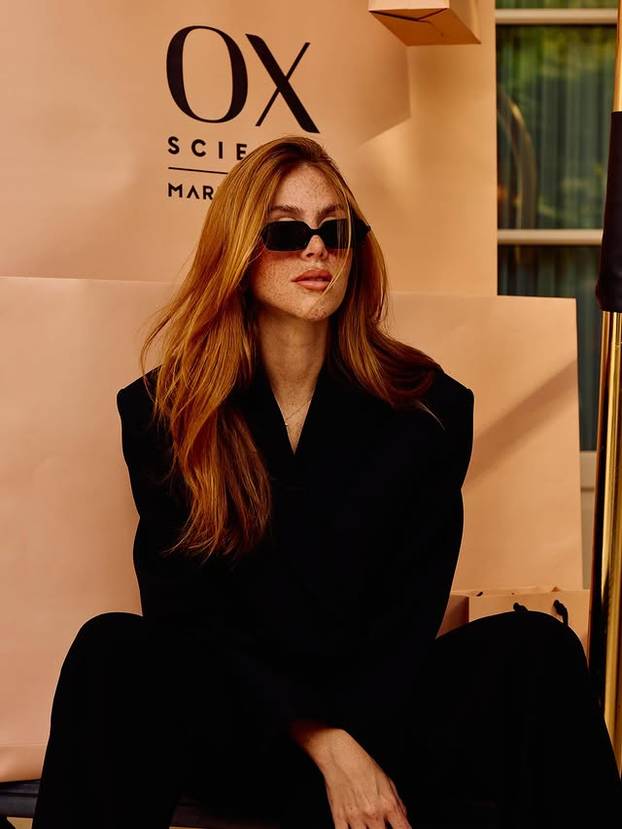 FOTO Posebna ljepota: Milijuni ljudi obožavaju njezine pjegice