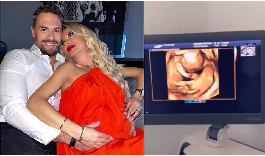 Šuput otkrila: Nenad će porod gledati uživo preko videopoziva