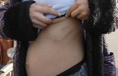 Bijesni pas izgrizao trbuh trudnici u romskom naselju
