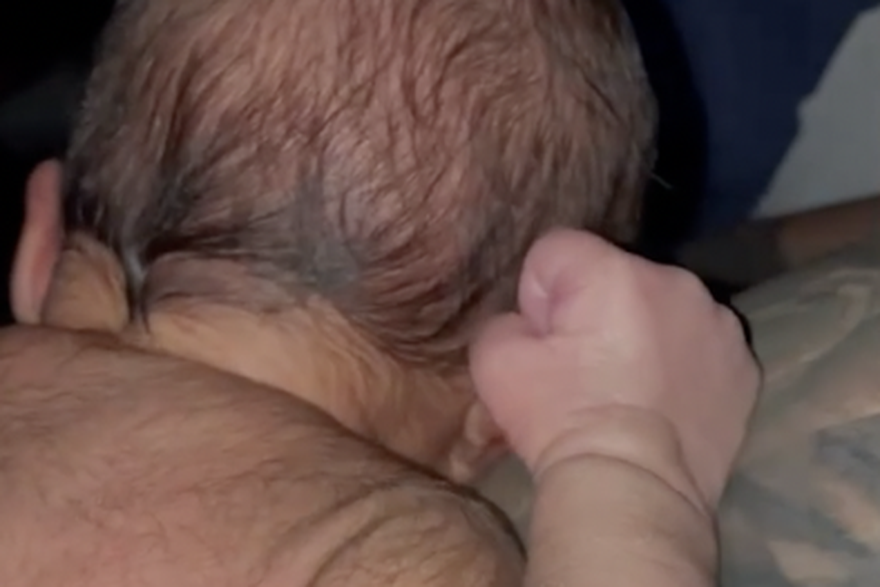 Majka iz Australije prozvala svoju bebu 'majmunčićem': 'Rodila se s crnim dlakama po tijelu'