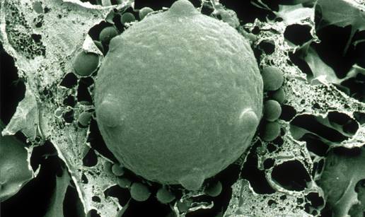 Najopakiji patogen ikad: I ljudi ga šire, a ubija na stotine vrsta