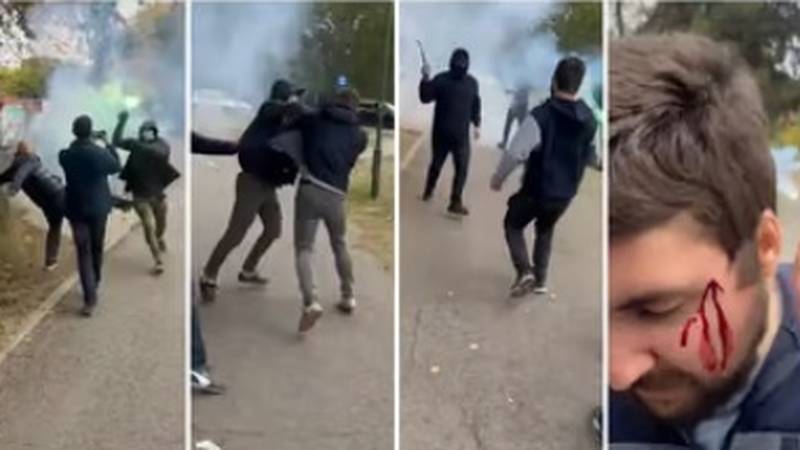 Maskirani napadači palicama i bakljama tukli mladiće ispred biračkog mjesta u Pančevu