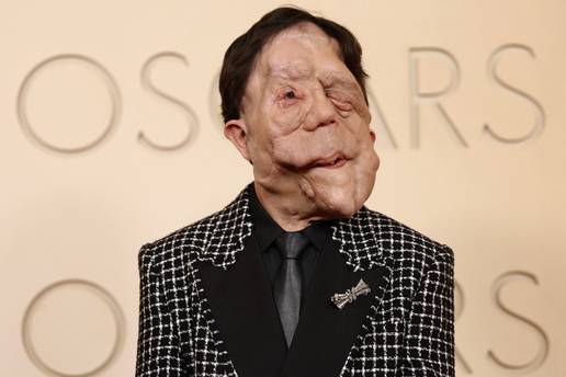 Adam se cijeli &zcaron;ivot suo&ccaron;avao s predrasudama, sada uspjehom pomi&ccaron;e granice Hollywooda