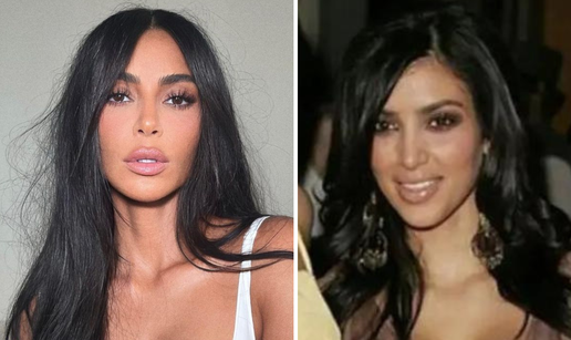 Je li Kim Kardashian imala neke estetske operacije? Obožavatelji kažu: 'Kao da je smanjila grudi'