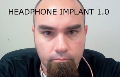 Nosi nevidljive slušalice: U uši si kirurški ugradio zvučnike