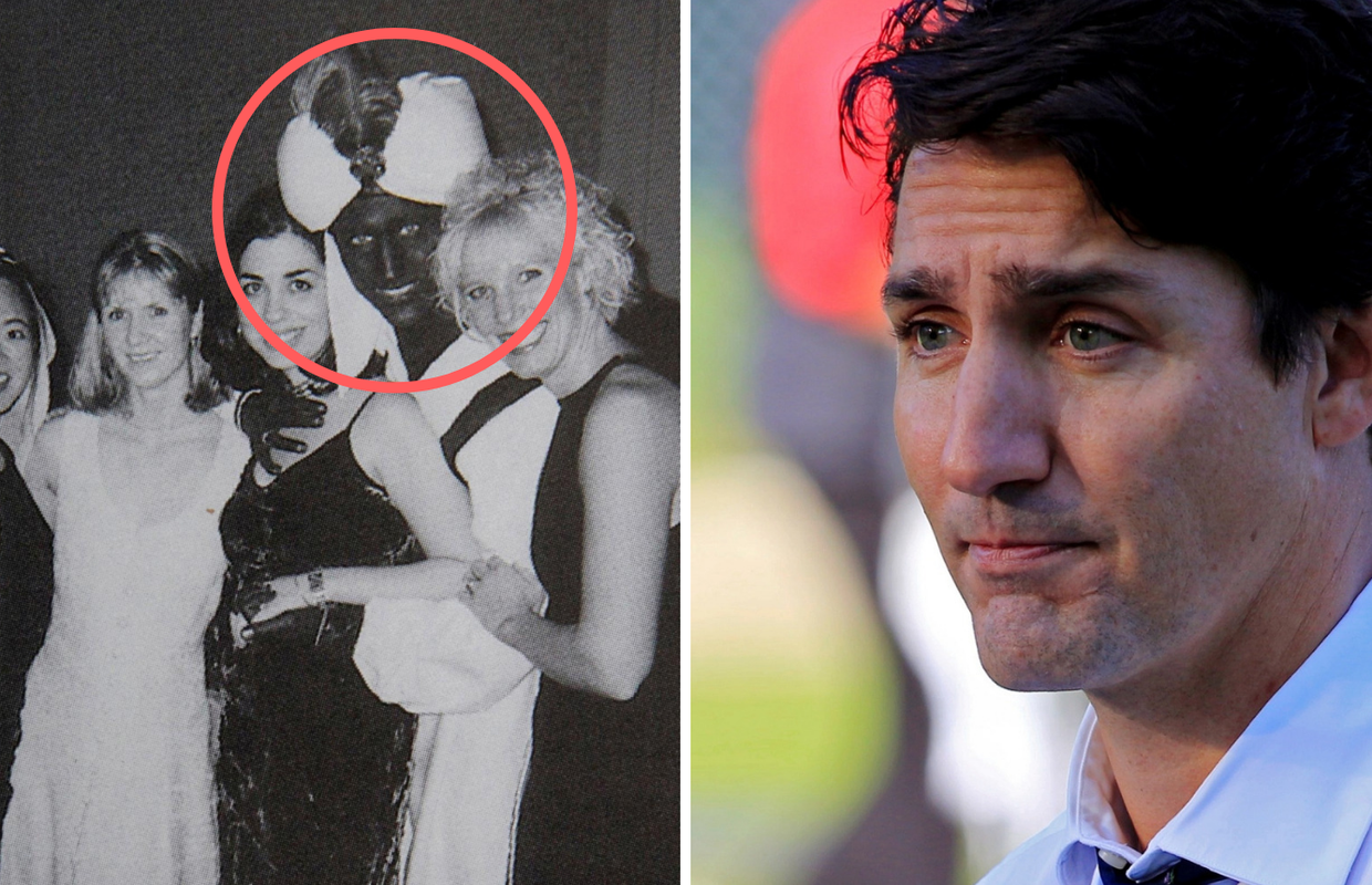 Trudeau se ispričao: 'Da, bojao sam lice u crno, nisam to smio'