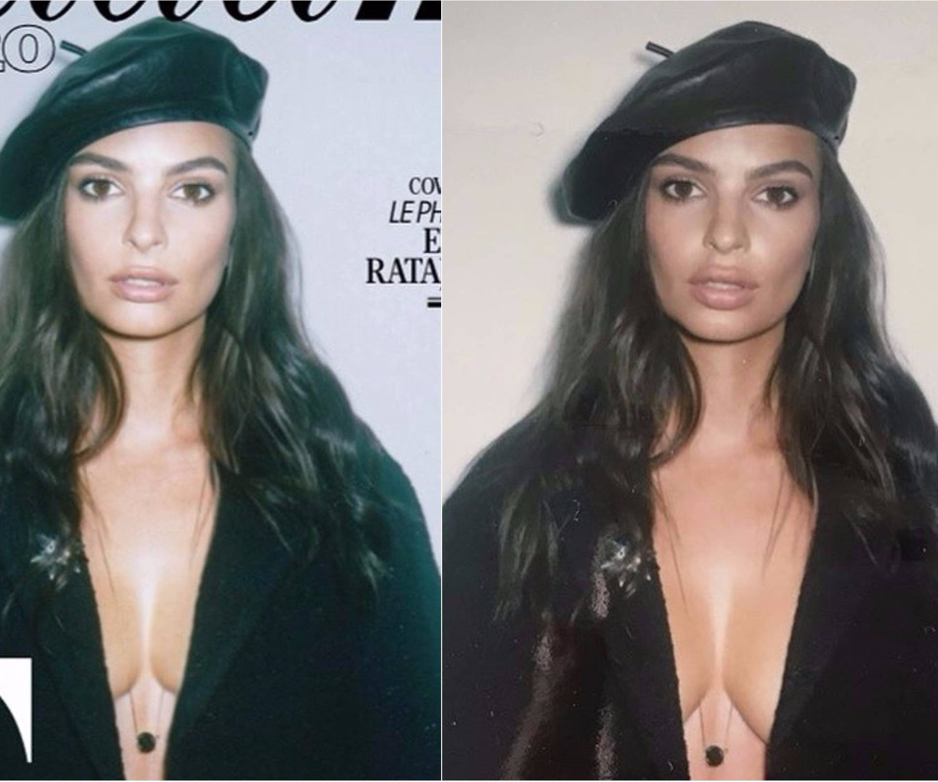 Ljuta je: Emily Ratajkowski za naslovnicu smanjili grudi i usne