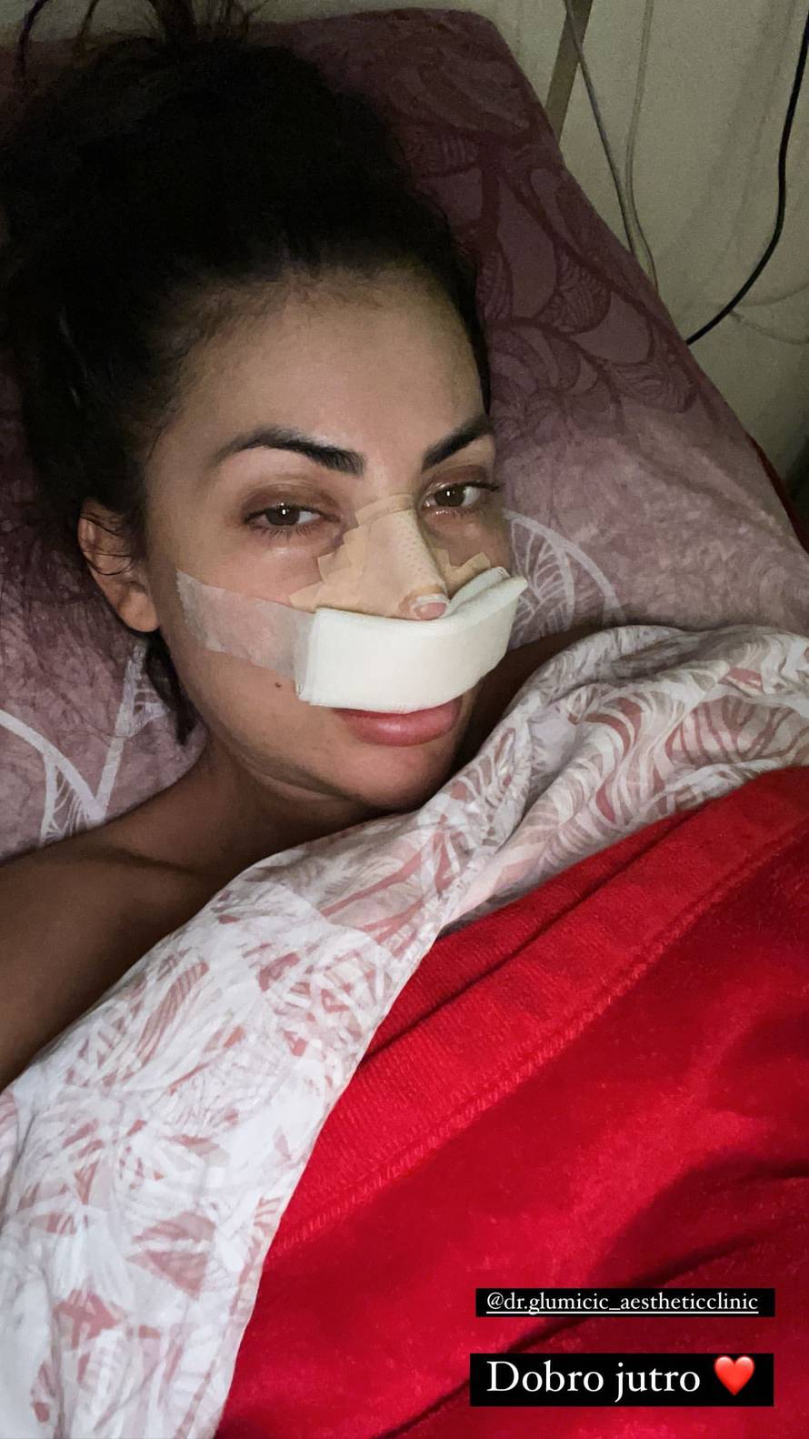 Hana Rodić prije svih operacija izgledala je potpuno drukčije: Evo koje je sve korekcije radila