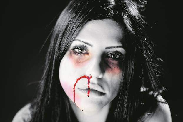 woman with bleeding nose after domestic violence