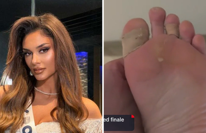 Misica Laura objavila je fotke stopala: 'Teže nego na Hitnoj'