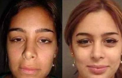 Larissa Riquelme: Prije i poslije plastičnih operacija