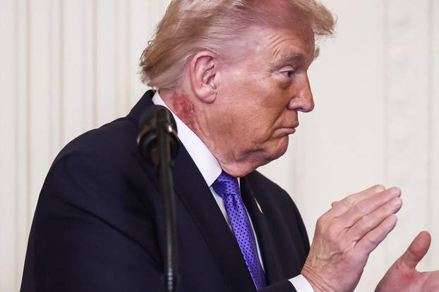 US President Donald Trump attends a medal of honor ceremony in the East Room of the White House in Washington, DC, USA. 02nd Mar, 2026. The President has a red rash on the right side of his neck. Credit: Abaca Press/Alamy Live News
