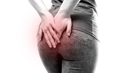 Diskretno i brzo: Kraj muke s pilonidalnim sinusom